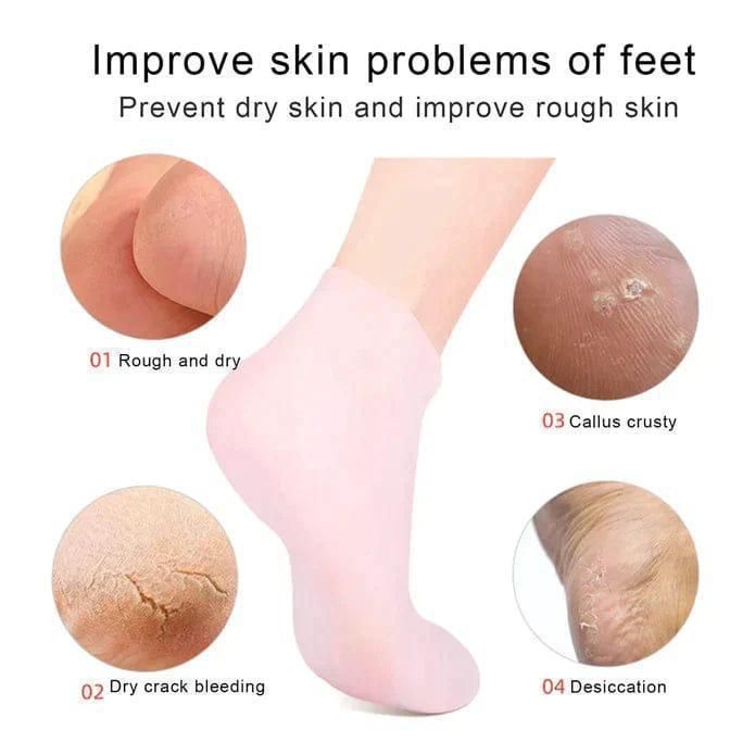 Moisturizing Foot Socks – Repair Dry, Cracked & Rough Skin
