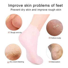 Moisturizing Foot Socks – Repair Dry, Cracked & Rough Skin
